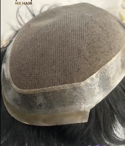 Austrailia hair patch Australia hair patch